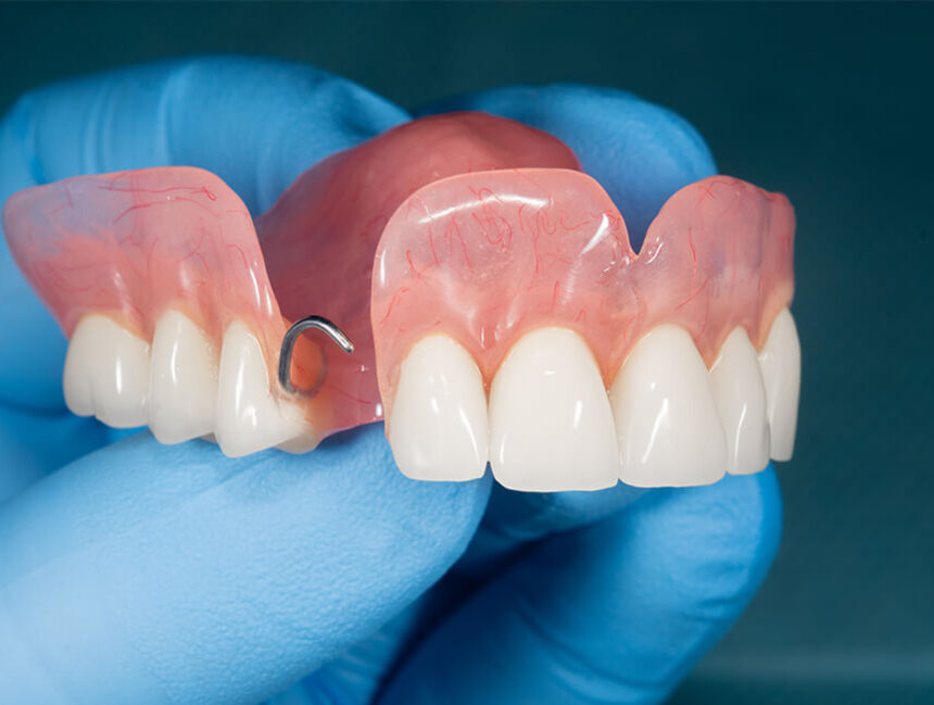 Partial Dentures